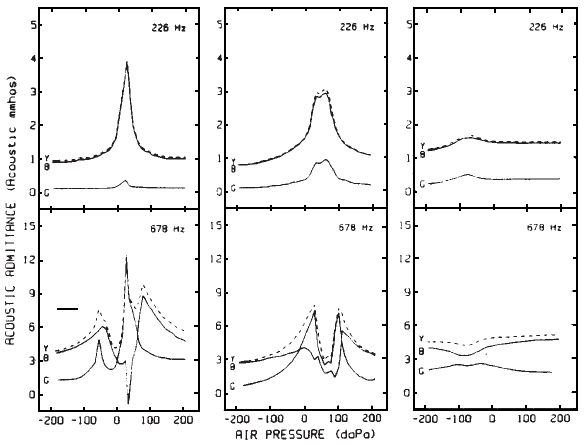 A diagram for plotting findings for tympanometry and acoustic reflexes