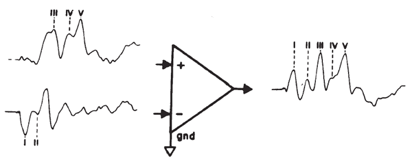 Figure 21