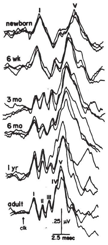 Figure 28