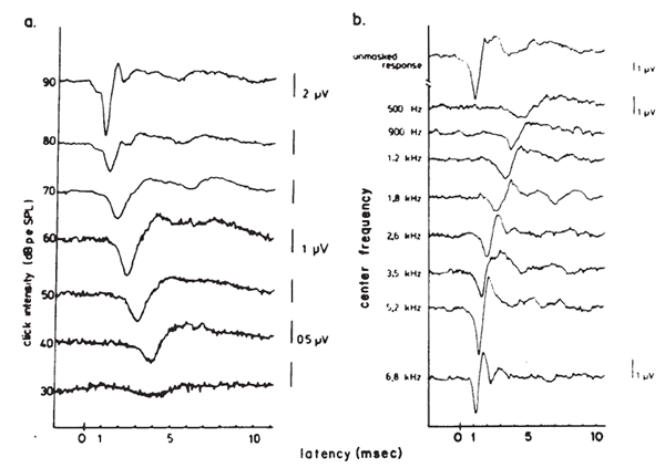 Short Latency Auditory Evoked