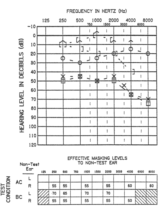 skrivestil årsag Tøj Audiometric Symbols